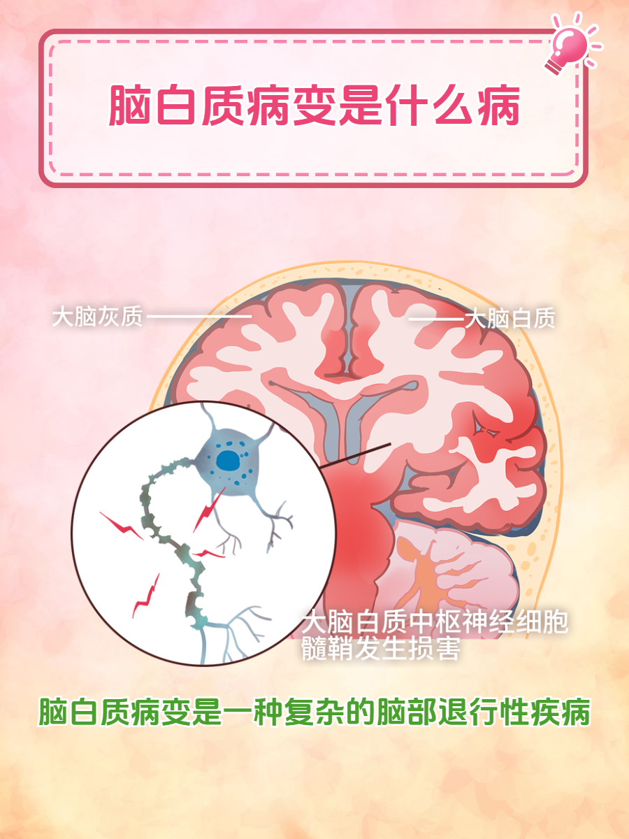 科普丨为什么我们的大脑有时会一片空白