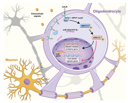 最新研究揭示动脉粥样硬化加剧脑白质损伤的机制