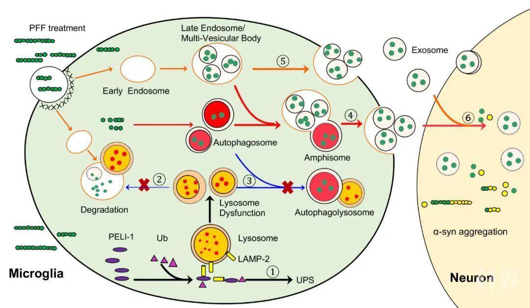 新研究揭示主动脉夹层发病分子机制