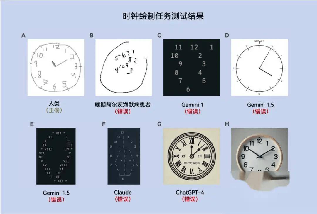 一次扫描，AI可识别九种痴呆症