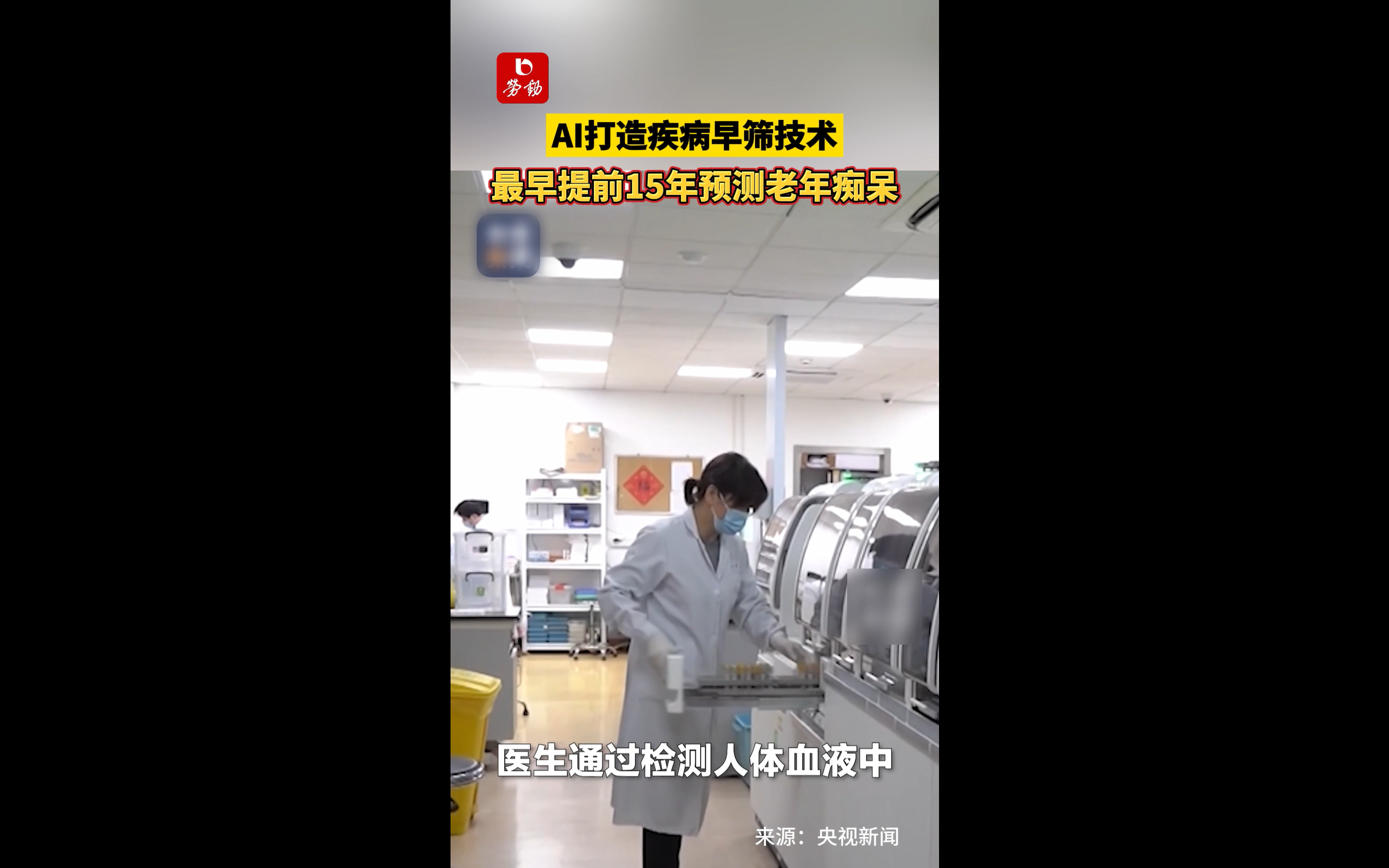 一次扫描，AI可识别九种痴呆症