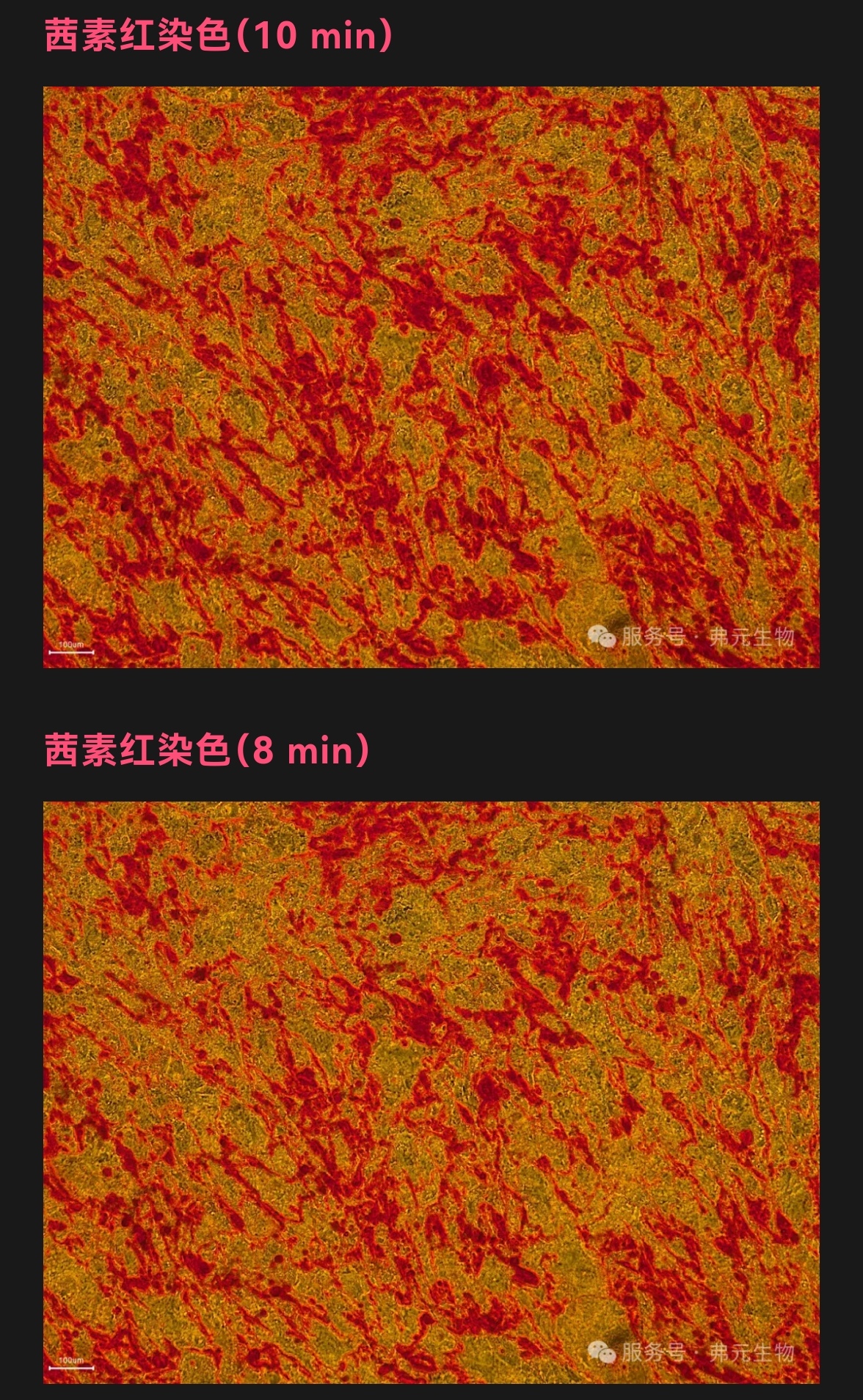 研究说一种趋化因子有望用于优化人造血液生产