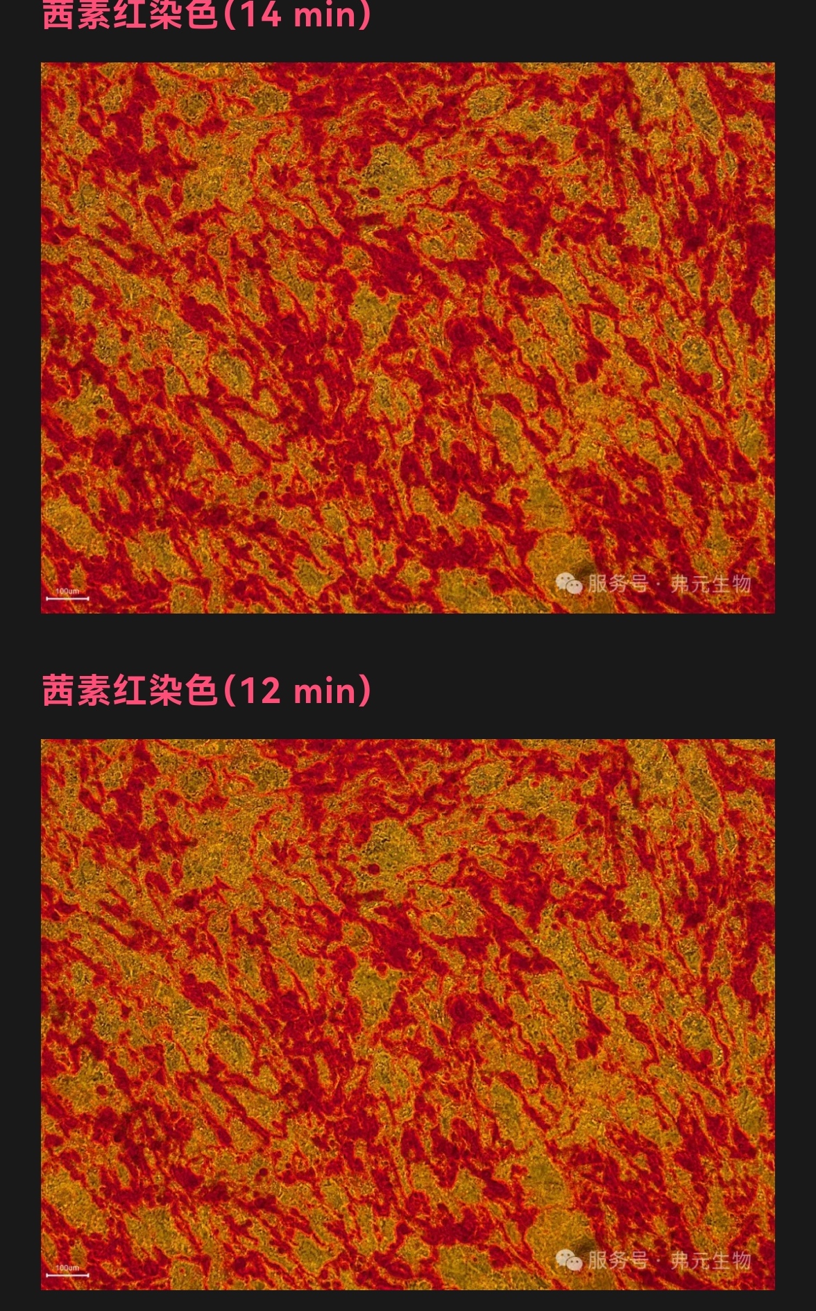 研究说一种趋化因子有望用于优化人造血液生产