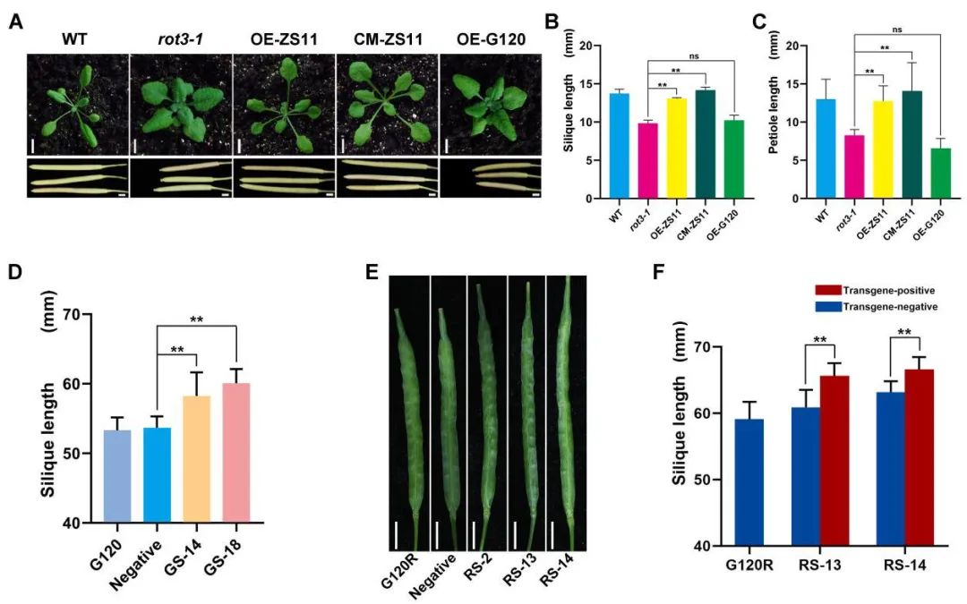 我国科学家发现大豆种子油蛋比调控关键基因