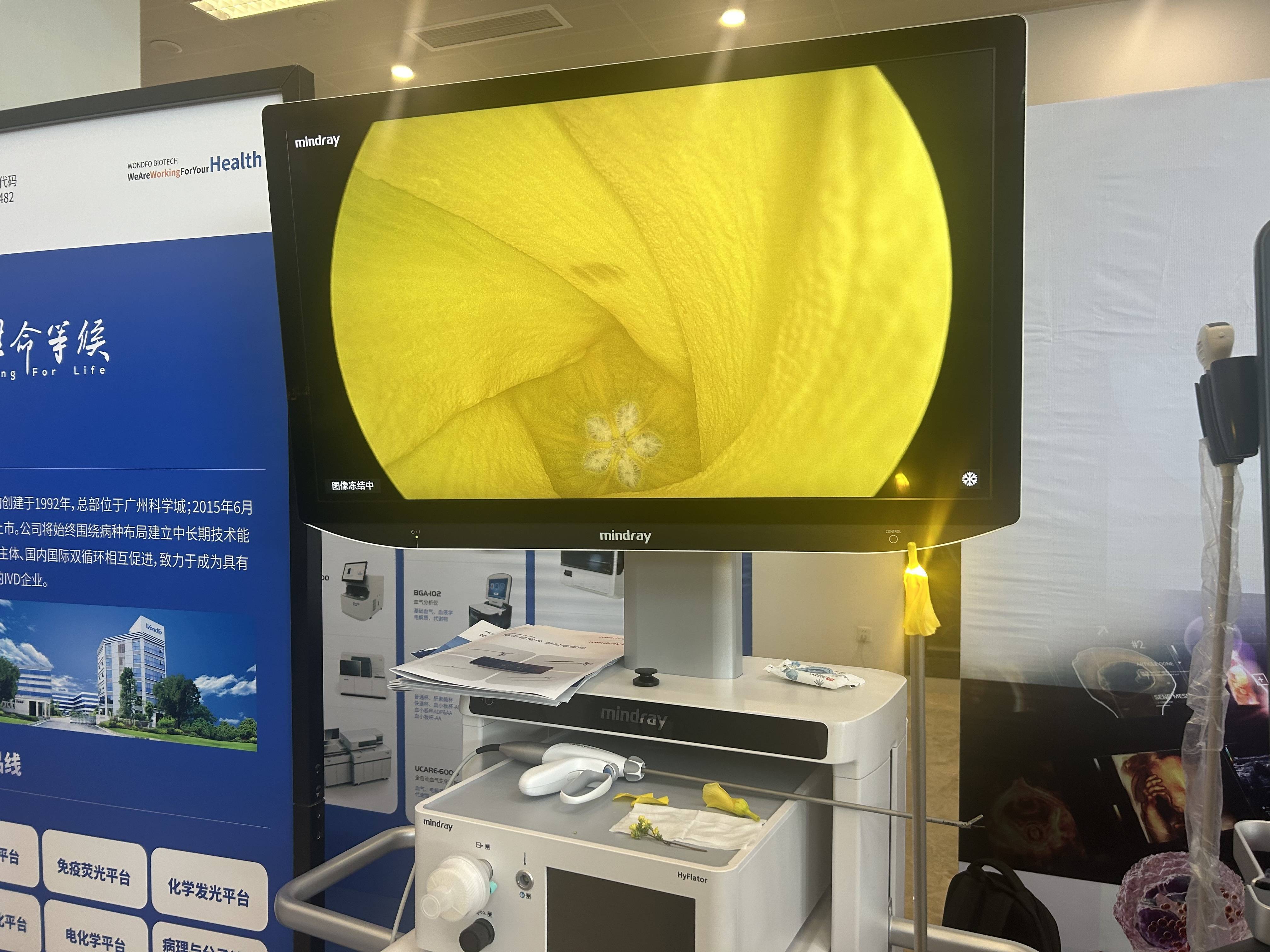 迈瑞医疗获得发明专利授权：“显示超声图像的方法、电子设备和超声成像系统”