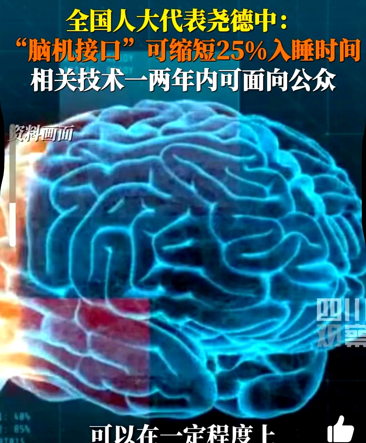 研究人员利用脑机接口尝试解码内心独白