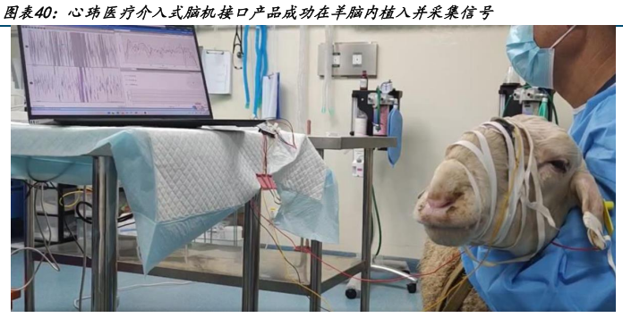 思维现实加速“链接” 脑机接口迈入产业化快车道