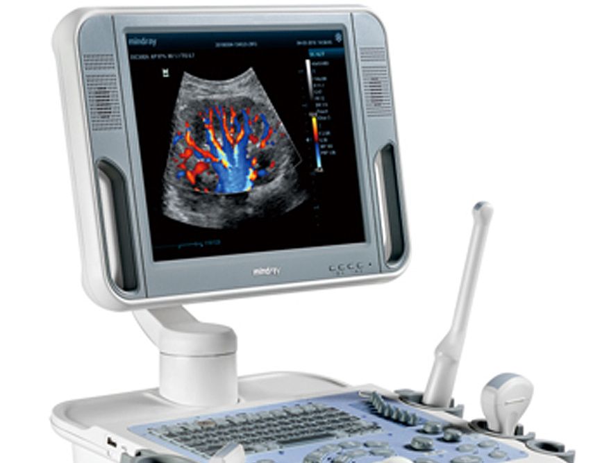 迈瑞医疗获得发明专利授权：“血管壁剪切指数显示方法及超声成像系统”