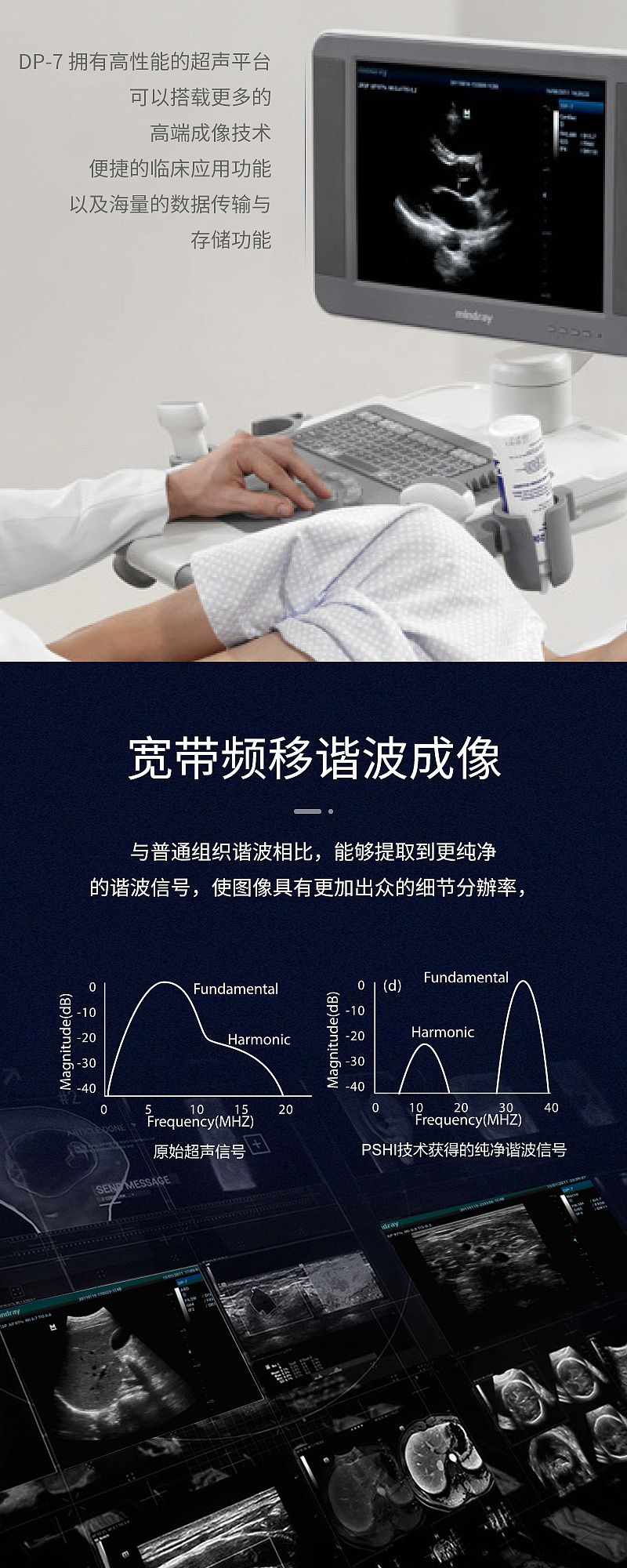 迈瑞医疗获得发明专利授权：“血管壁剪切指数显示方法及超声成像系统”