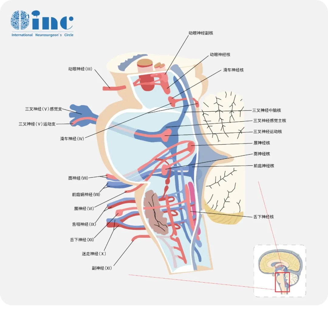 AI算法自动解析脑干白质神经束
