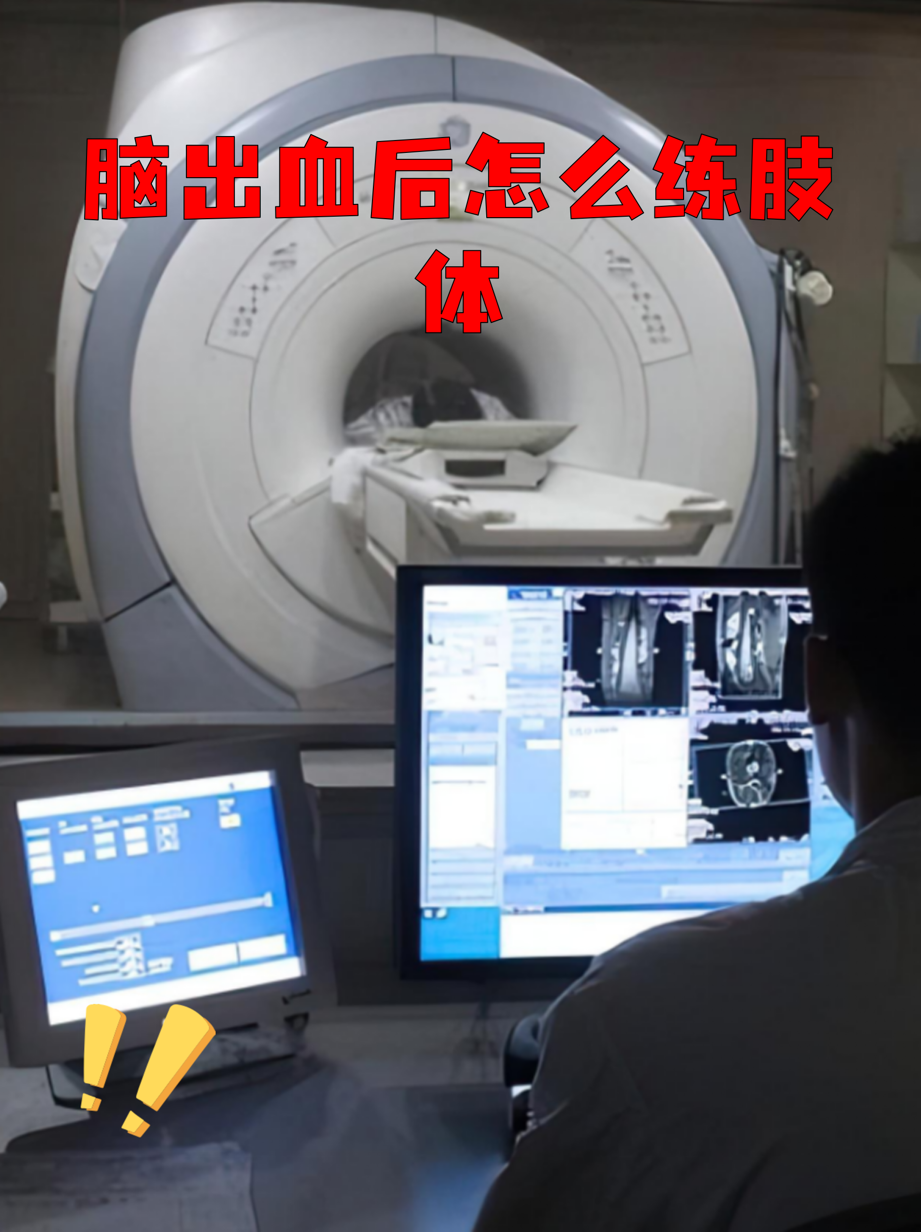 直击脑机接口技术“痛点”，前沿探索正多路并进